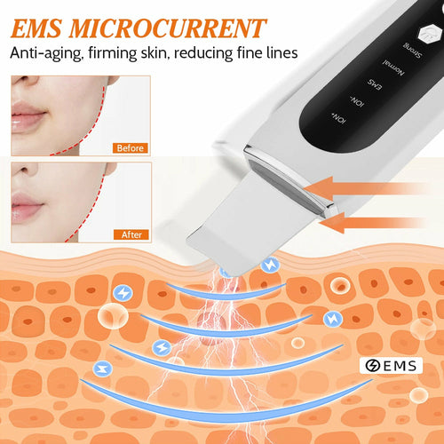 Ultrasonic Skin Scrubber with EMS Microcurrent