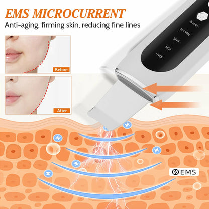 Ultrasonic Skin Scrubber with EMS Microcurrent